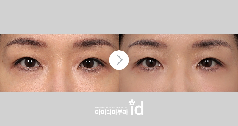 아이서마지 리뷰 조건에 맞는 방향으로 7