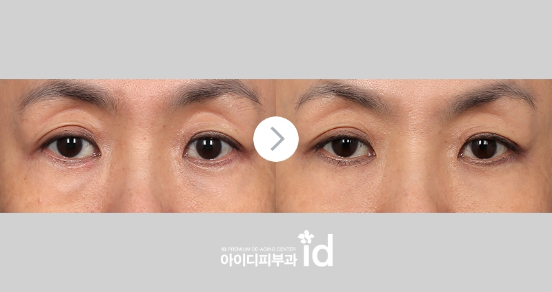 아이서마지 리뷰 조건에 맞는 방향으로 9